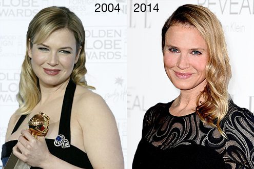 renee zellweger - cirugia estetica-2014