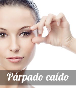 Ptosis palpebral, causas y tratamiento