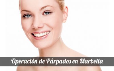 Blepharoplasty in Marbella