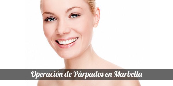 Blepharoplasty in Marbella