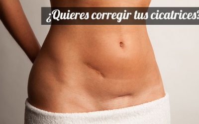 Corrección de cicatrices quirúrgicas con Cirugía Plástica