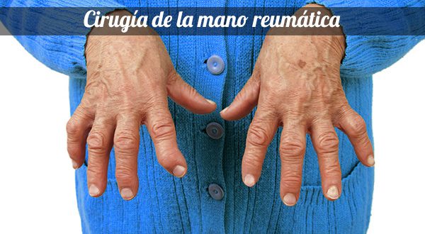 Cirugía de la mano reumática