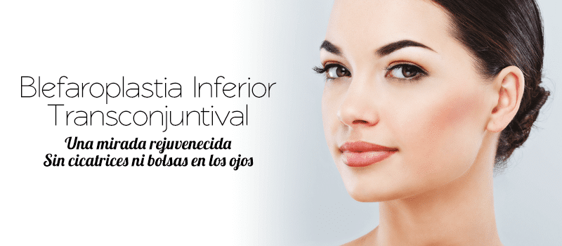 Cantopexia para tensar un párpado inferior caído