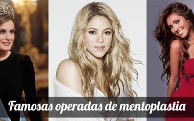 Mentoplastia Famosos
