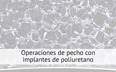 Operaciones de pecho con implantes de poliuretano
