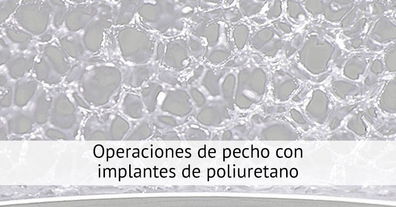 Operaciones de pecho con implantes de poliuretano