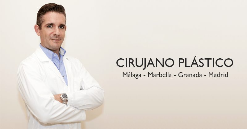 Plastic surgeon in Marbella